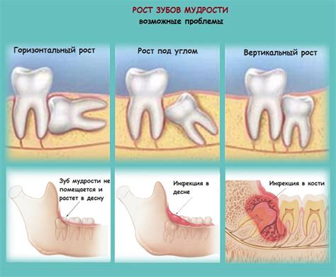Причины и лечение боли в суставе после лечения зубов